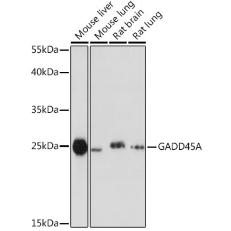 Western Blot - Anti-GADD45A Antibody (A80636) - Antibodies.com