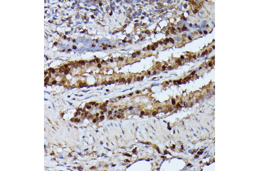 Immunohistochemistry - Anti-GADD45A Antibody (A80636) - Antibodies.com