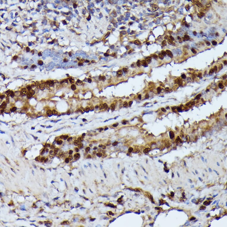 Immunohistochemistry - Anti-GADD45A Antibody (A80636) - Antibodies.com