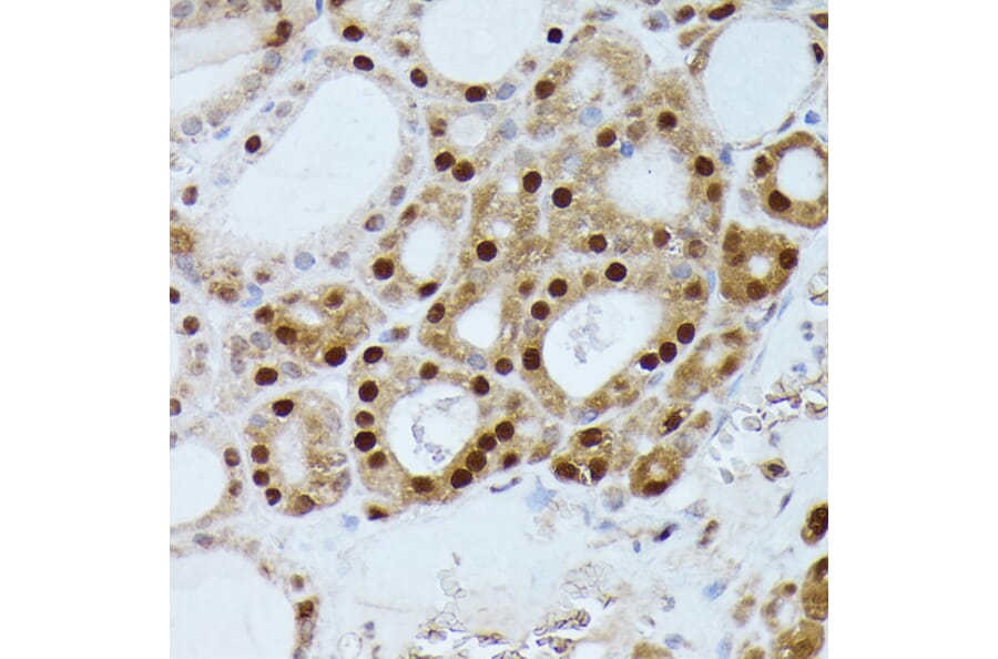 Immunohistochemistry - Anti-GADD45A Antibody (A80636) - Antibodies.com