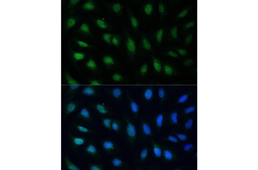 Immunofluorescence - Anti-GADD45A Antibody (A80636) - Antibodies.com