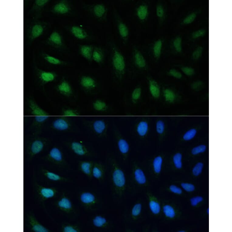 Immunofluorescence - Anti-GADD45A Antibody (A80636) - Antibodies.com