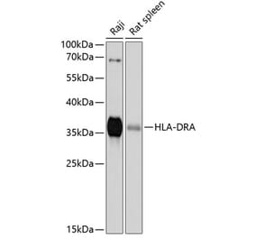 Western Blot - Anti-HLA-DR Antibody (A80638) - Antibodies.com