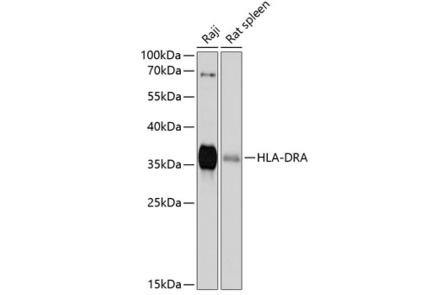 Western Blot - Anti-HLA-DR Antibody (A80638) - Antibodies.com