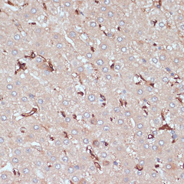 Immunohistochemistry - Anti-HLA-DR Antibody (A80638) - Antibodies.com