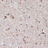 Immunohistochemistry - Anti-HLA-DR Antibody (A80638) - Antibodies.com