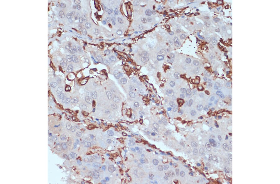 Anti-HLA-DR Antibody (A80638) | Antibodies.com