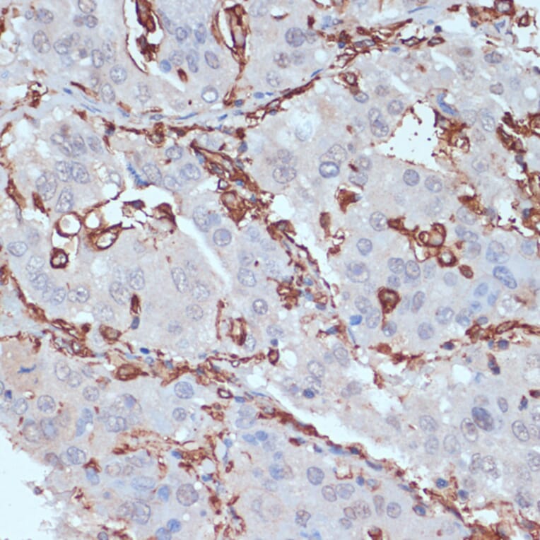 Immunohistochemistry - Anti-HLA-DR Antibody (A80638) - Antibodies.com