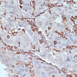 Immunohistochemistry - Anti-HLA-DR Antibody (A80638) - Antibodies.com