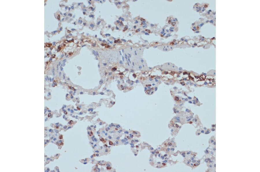 Immunohistochemistry - Anti-HLA-DR Antibody (A80638) - Antibodies.com