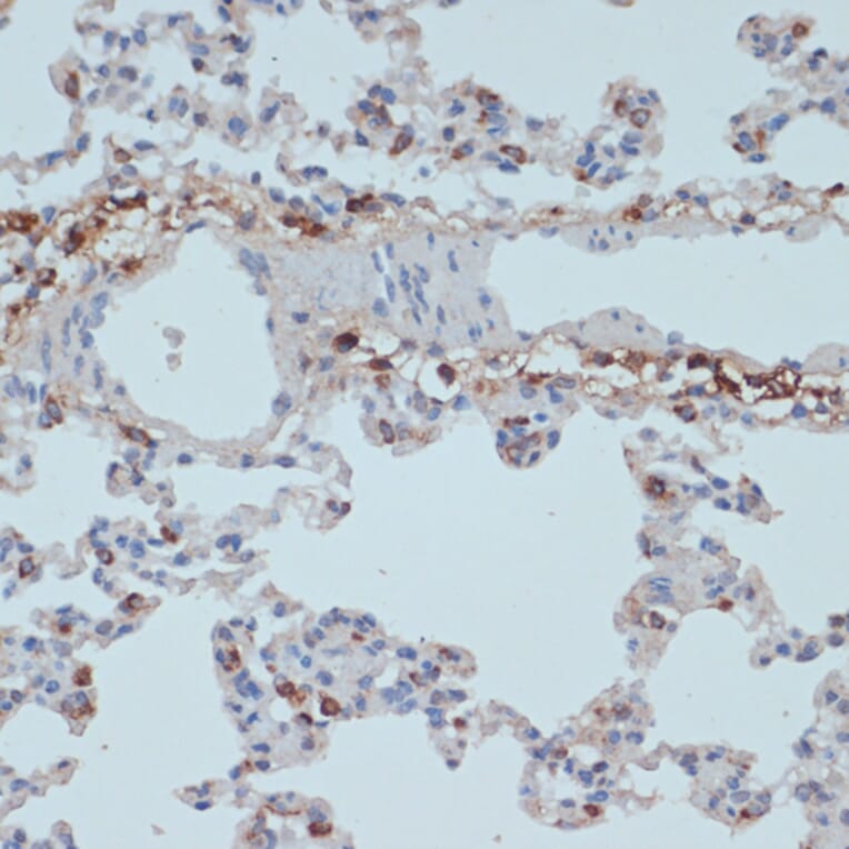 Immunohistochemistry - Anti-HLA-DR Antibody (A80638) - Antibodies.com
