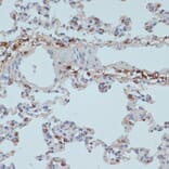 Immunohistochemistry - Anti-HLA-DR Antibody (A80638) - Antibodies.com