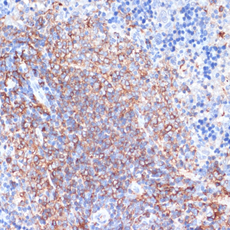 Immunohistochemistry - Anti-HLA-DR Antibody (A80638) - Antibodies.com