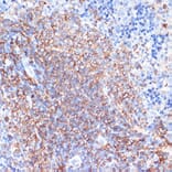 Immunohistochemistry - Anti-HLA-DR Antibody (A80638) - Antibodies.com