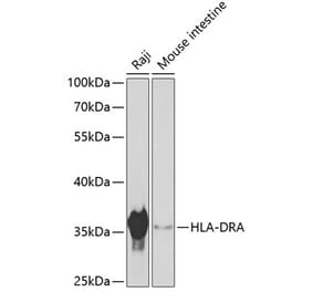 Western Blot - Anti-HLA-DR Antibody (A80639) - Antibodies.com