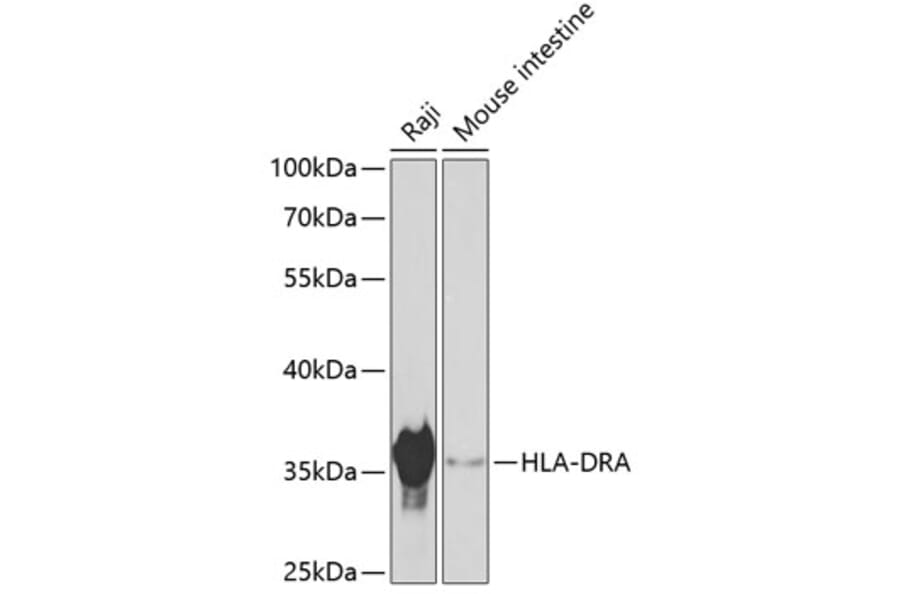 Western Blot - Anti-HLA-DR Antibody (A80639) - Antibodies.com