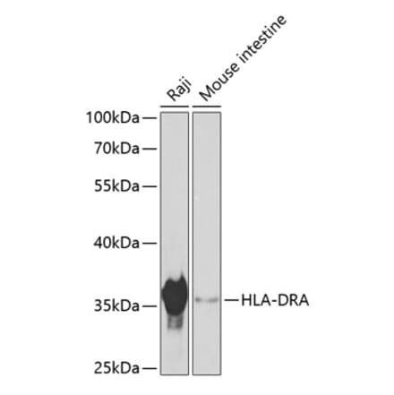Western Blot - Anti-HLA-DR Antibody (A80639) - Antibodies.com