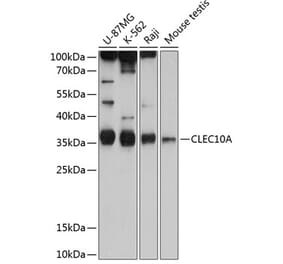 Western Blot - Anti-CLEC10A Antibody (A80640) - Antibodies.com