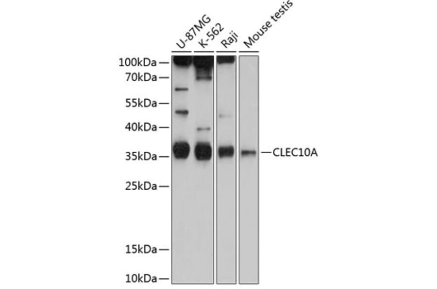 Western Blot - Anti-CLEC10A Antibody (A80640) - Antibodies.com