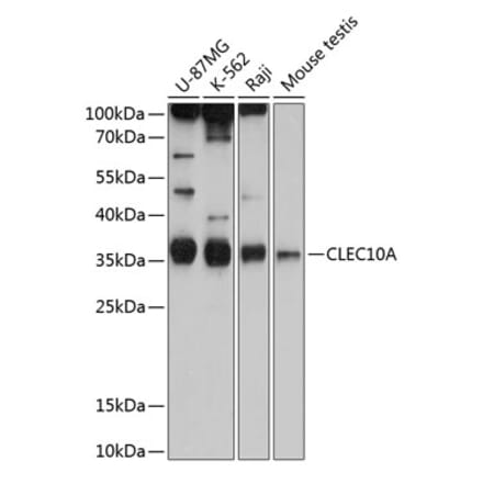 Western Blot - Anti-CLEC10A Antibody (A80640) - Antibodies.com