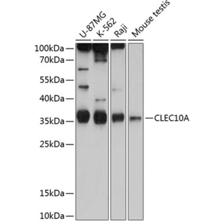 Western Blot - Anti-CLEC10A Antibody (A80640) - Antibodies.com