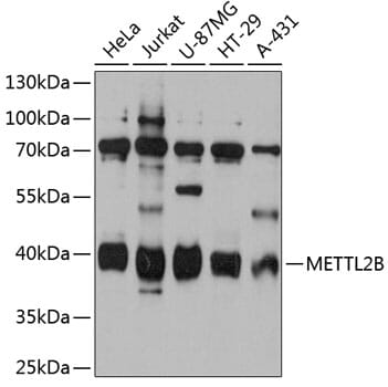 Western blot analysis of extracts of various cell lines, using Anti-METTL2B Antibody (A12082) at 1:3000 dilution.
Secondary antibody: Goat Anti-Rabbit IgG (H+L) (HRP) (AS014) at 1:10,000 dilution.
Lysates / proteins: 25µg per lane.
Blocking buffer: 3% non-fat dry milk in TBST.
Detection: ECL Basic Kit (RM00020).
Exposure time: 90s.