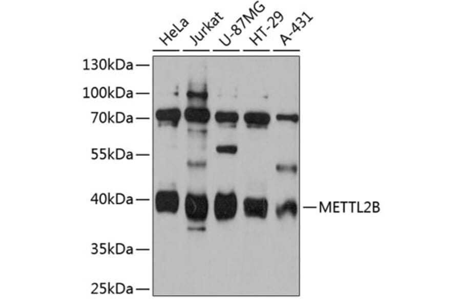 Western Blot - Anti-METTL2B Antibody (A80642) - Antibodies.com