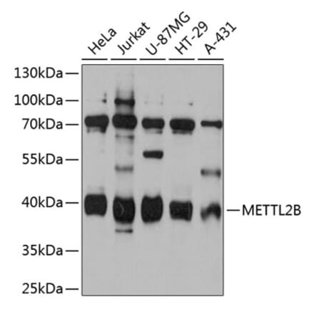 Western Blot - Anti-METTL2B Antibody (A80642) - Antibodies.com