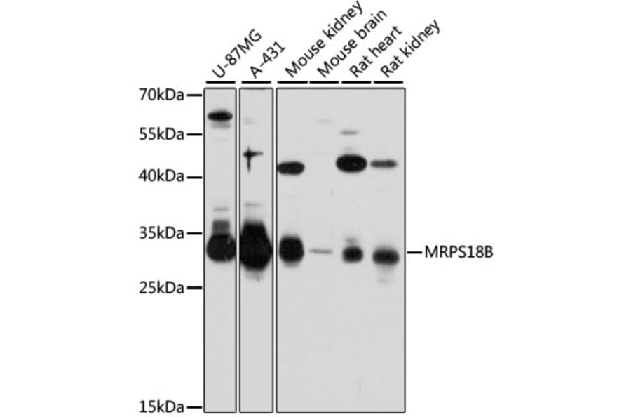 Western Blot - Anti-MRPS18B Antibody (A80643) - Antibodies.com