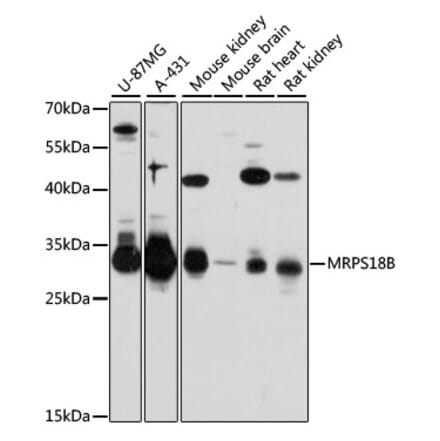 Western Blot - Anti-MRPS18B Antibody (A80643) - Antibodies.com