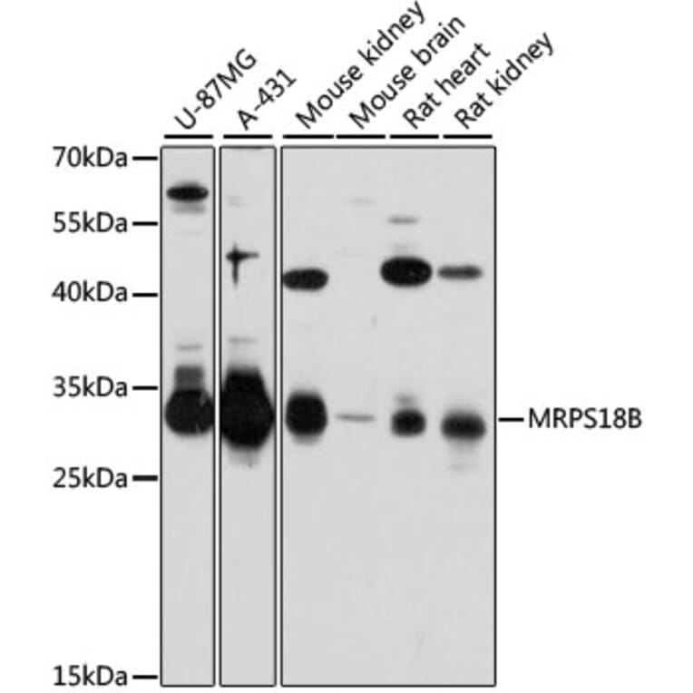 Western Blot - Anti-MRPS18B Antibody (A80643) - Antibodies.com