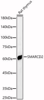 Western blot analysis of extracts of various cell lines, using Anti-SMARCD2 Antibody (A12104) at 1:3000 dilution.
Secondary antibody: Goat Anti-Rabbit IgG (H+L) (HRP) (AS014) at 1:10,000 dilution.
Lysates / proteins: 25µg per lane.
Blocking buffer: 3% non-fat dry milk in TBST.
Detection: ECL Basic Kit (RM00020).
Exposure time: 30s.