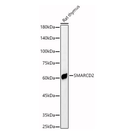 Western Blot - Anti-SMARCD2 Antibody (A80644) - Antibodies.com