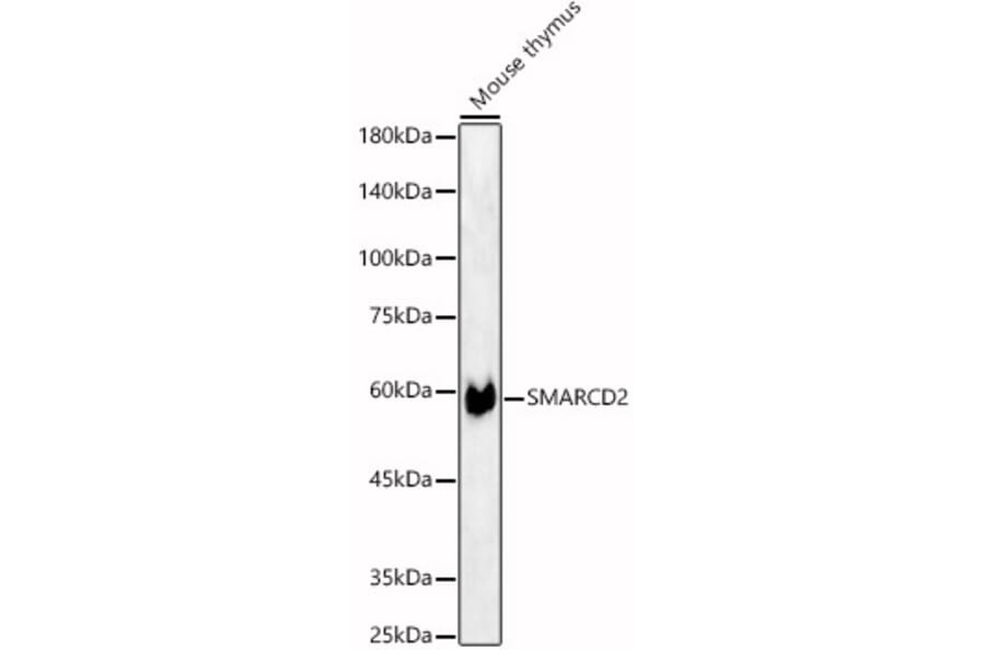 Western Blot - Anti-SMARCD2 Antibody (A80644) - Antibodies.com