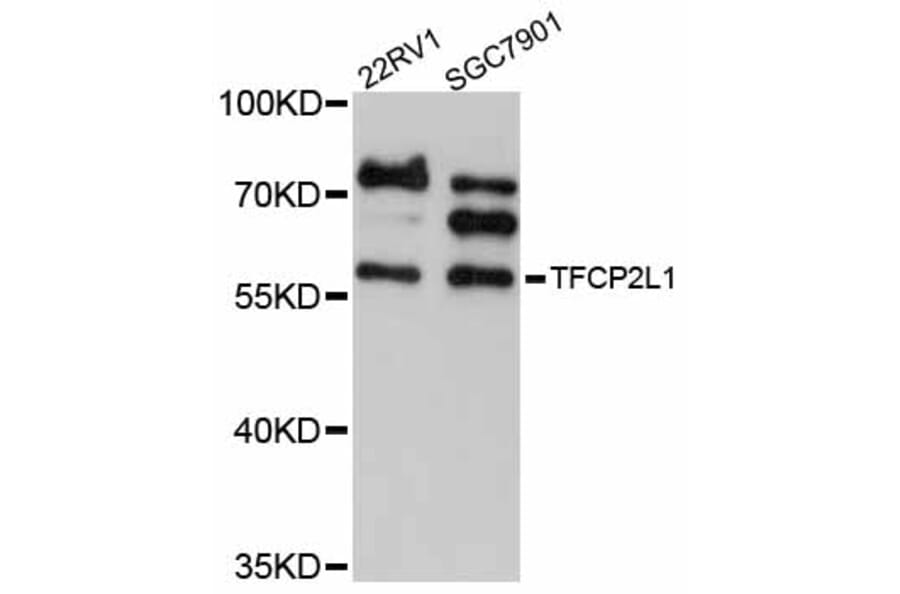 Western Blot - Anti-TFCP2L1 Antibody (A12140) - Antibodies.com