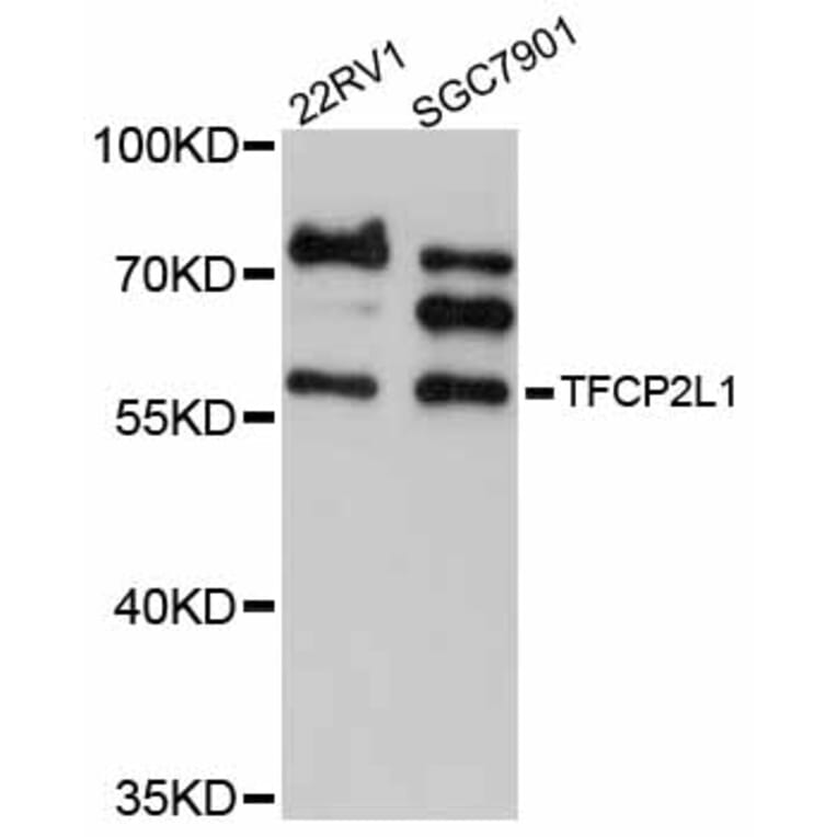 Western Blot - Anti-TFCP2L1 Antibody (A12140) - Antibodies.com