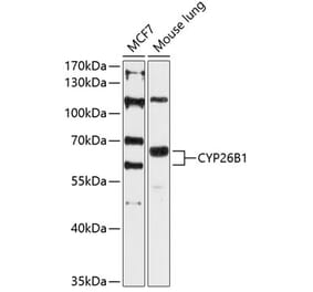Western Blot - Anti-Cyp26B1 Antibody (A80646) - Antibodies.com
