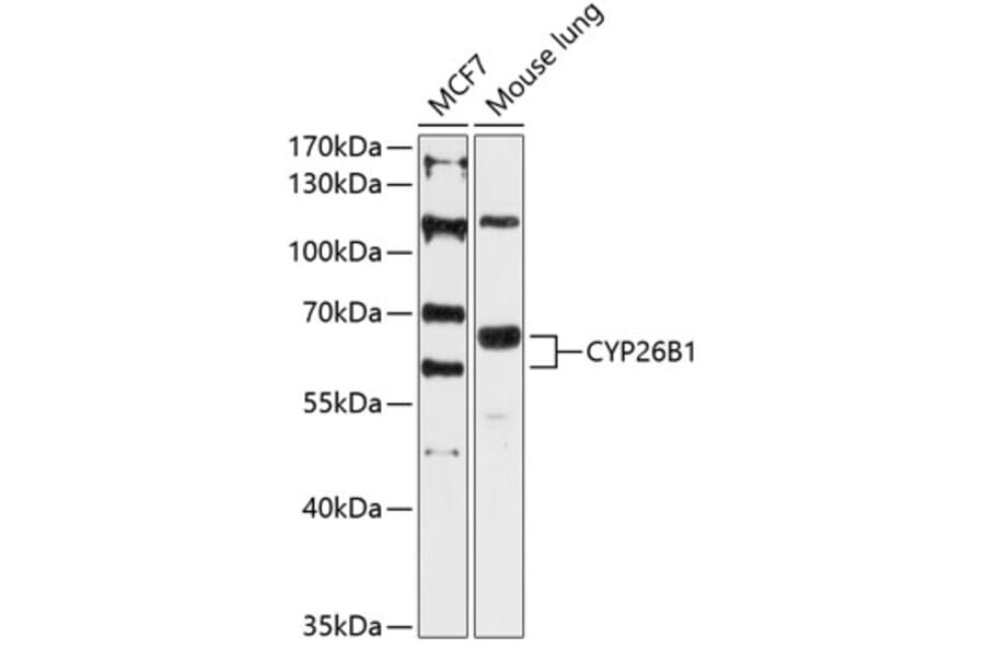 Western Blot - Anti-Cyp26B1 Antibody (A80646) - Antibodies.com