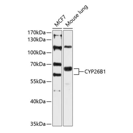 Western Blot - Anti-Cyp26B1 Antibody (A80646) - Antibodies.com