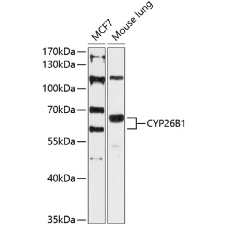 Western Blot - Anti-Cyp26B1 Antibody (A80646) - Antibodies.com