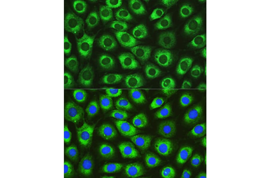 Immunofluorescence - Anti-DNAJC10 Antibody (A80647) - Antibodies.com