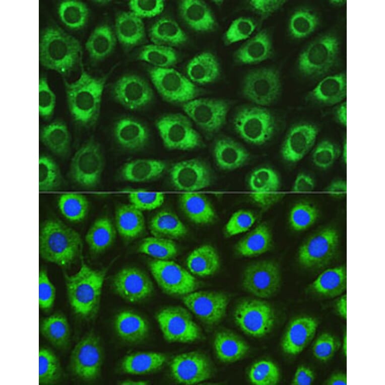 Immunofluorescence - Anti-DNAJC10 Antibody (A80647) - Antibodies.com