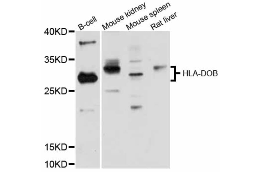 Western Blot - Anti-HLA-DOB Antibody (A12152) - Antibodies.com