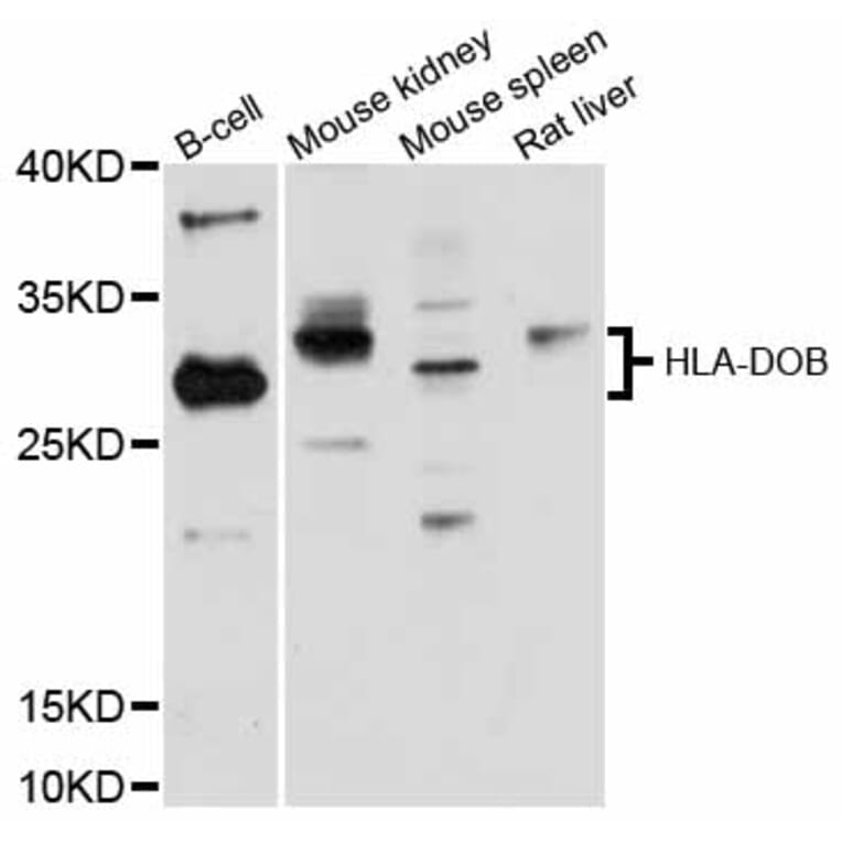 Western Blot - Anti-HLA-DOB Antibody (A12152) - Antibodies.com