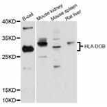 Western Blot - Anti-HLA-DOB Antibody (A12152) - Antibodies.com