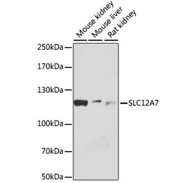 Western Blot - Anti-KCC4 Antibody (A80650) - Antibodies.com