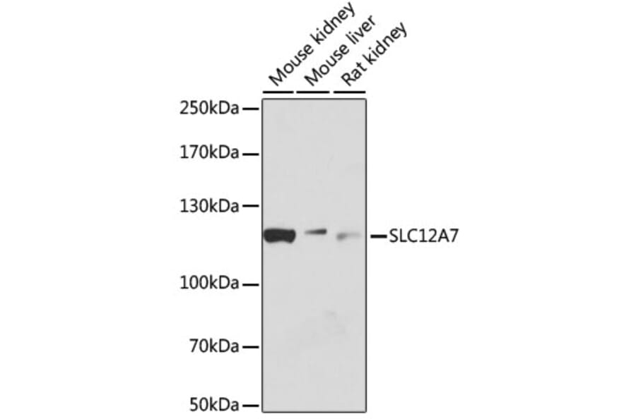 Western Blot - Anti-KCC4 Antibody (A80650) - Antibodies.com