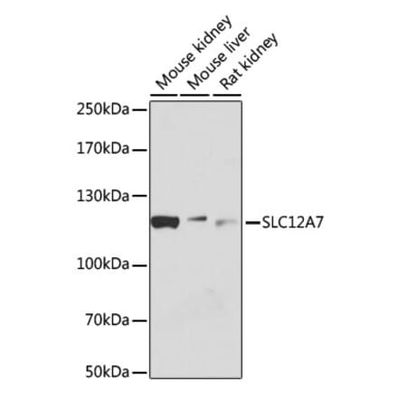 Western Blot - Anti-KCC4 Antibody (A80650) - Antibodies.com