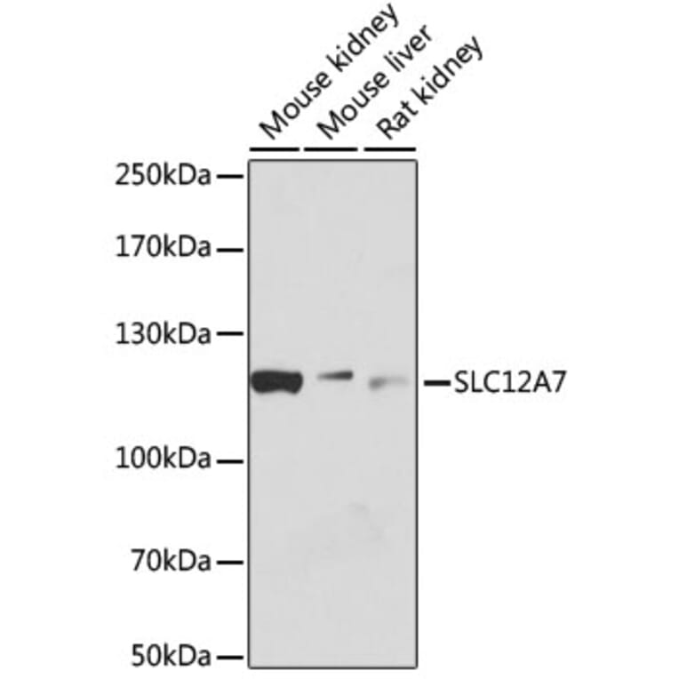 Western Blot - Anti-KCC4 Antibody (A80650) - Antibodies.com