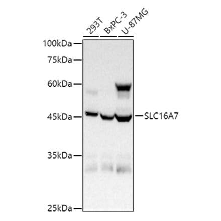 Western Blot - Anti-MCT2 Antibody (A80652) - Antibodies.com